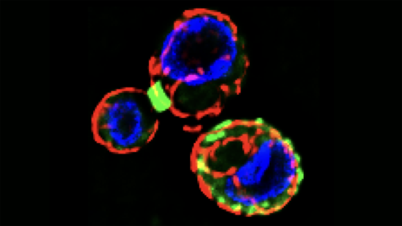 Septins (green), structural proteins common to all non-botanical eukaryotic life, were known to form rings that help separate mother and daughter cells during cell division (left). A new, student-led study has shown that septins are also involved in switching off autophagy, a recycling process within cells that is activated during times of stress, which they do by rearranging into localized patches that are scattered around the cell membrane (bottom right). (Ken Kaplan/UC Davis)