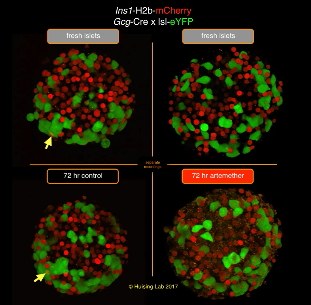 Shown alongside a control sample, the artemether sample failed to transform alpha cells into beta cells. Alpha cells are stained green and beta cells are red. Transdifferentiated cells would appear green with a red nucleus. Mark Huising/UC Davis
