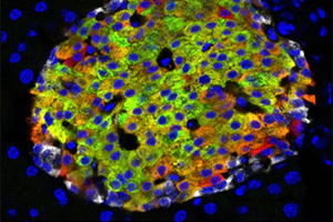 Huising's cell discovery: pancreatic islets make insulin in response to blood glucose. Red cells at the edges of the image show a new type of immature insulin-producing cell. Mark Huising/UC Davis