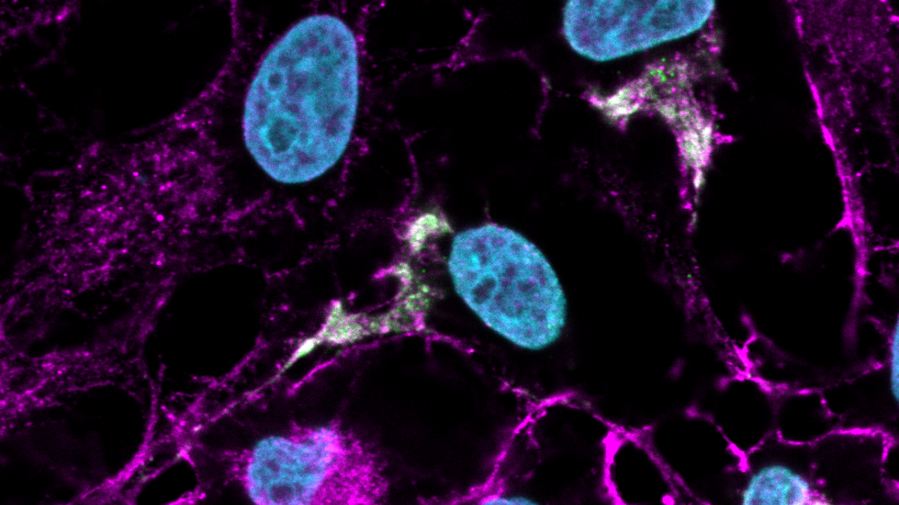 Researchers in Priya Shah's lab injected Zika virus (shown in green) into cells with ANKLE2 protein (magenta) and found that Zika replicates 10 to 100 times better in cells with ANKLE2 than in those without. (Adam Fishburn/UC Davis)