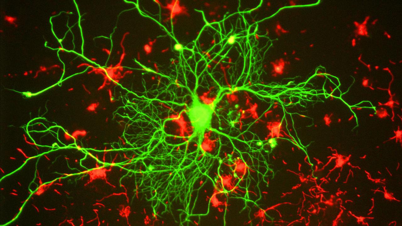 Researchers hope to gain a better visual perspective of the molecular mechanisms of the brain's continual rearrangement of neuronal connections, known collectively as brain plasticity. Gerry Shaw