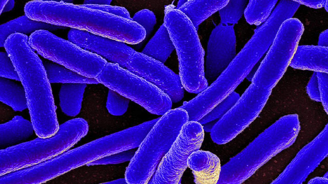 Microscopic image of Escherichia coli. Wikimedia Commons