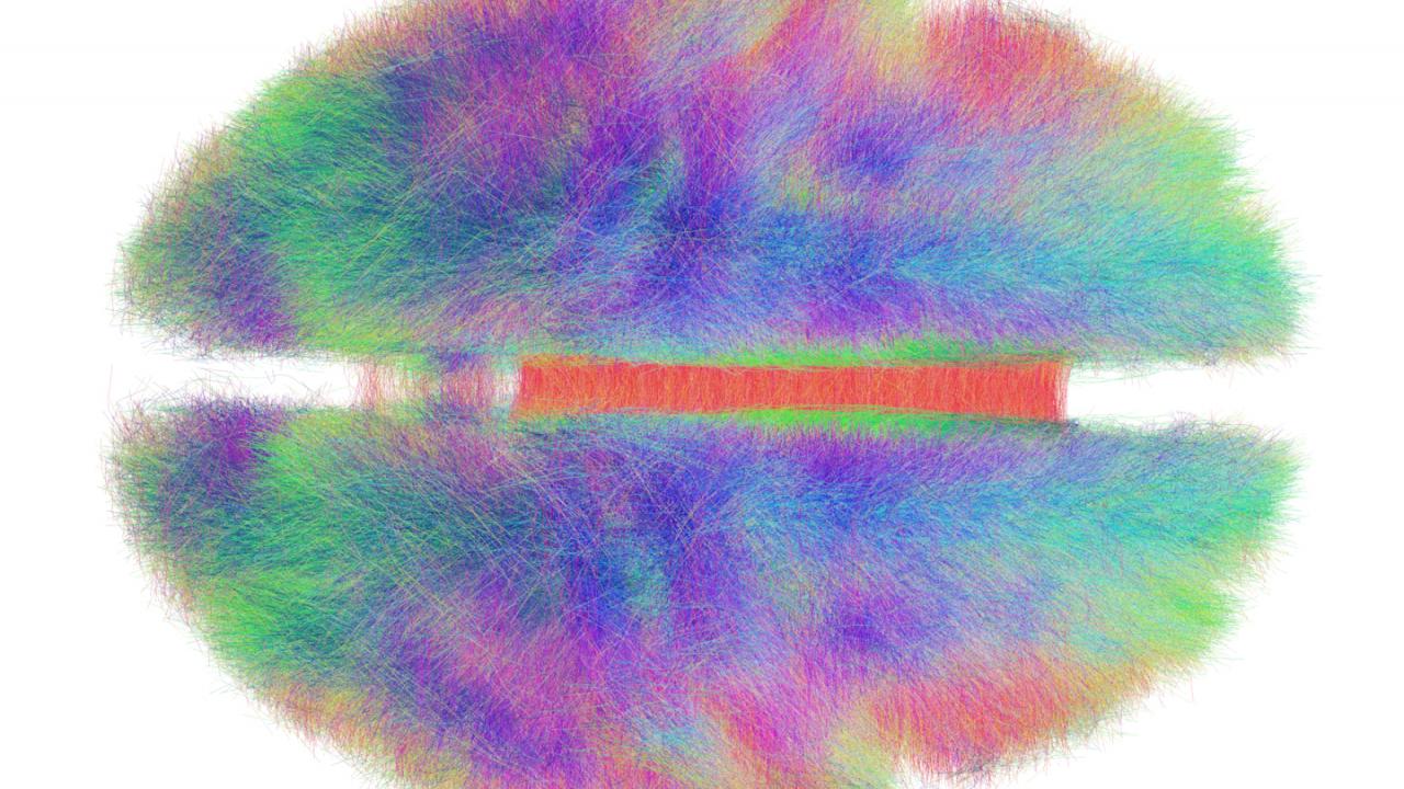 Big data visualization techniques like this connectome—a computer-generated map of the brain pathways of 20 humans—inform neuroscience and help create models of complex biological systems. Andreas Horn/Max Planck Institute for Human Development