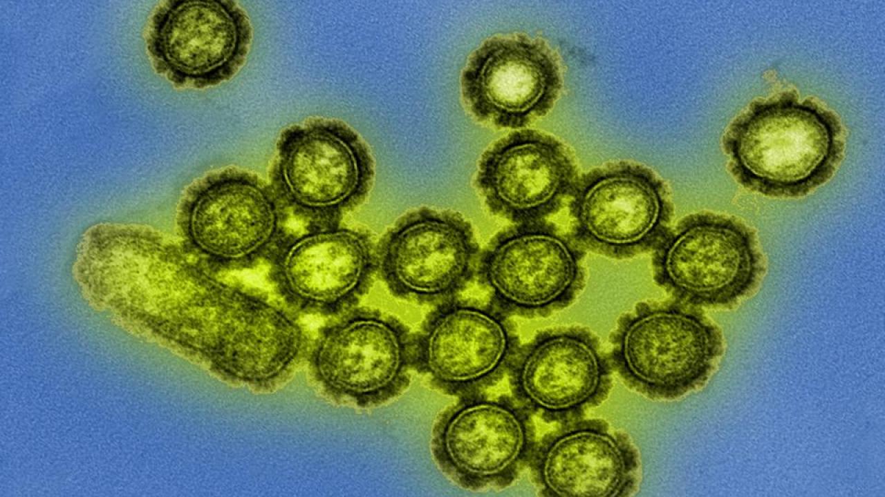 Viruses like these H1N1 influenza particles rely on host cells to reproduce, but they can still show social behavior, interacting with other viruses by competing, cooperating and sometimes cheating to succeed. This new behavioral approach to viruses could lead to new insights into how to control infectious diseases. Photo credit: NIH/NIAID