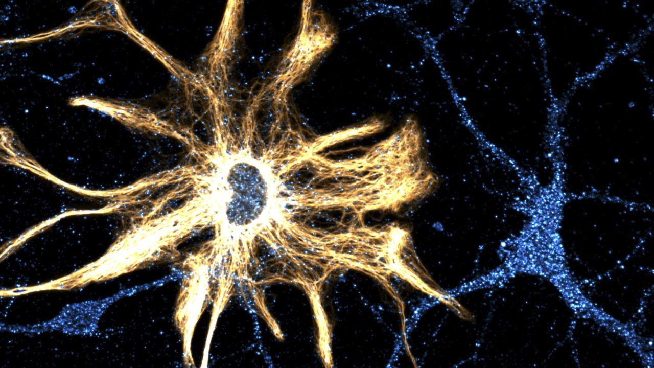 Image of neurons from the hippocampus in blue and white