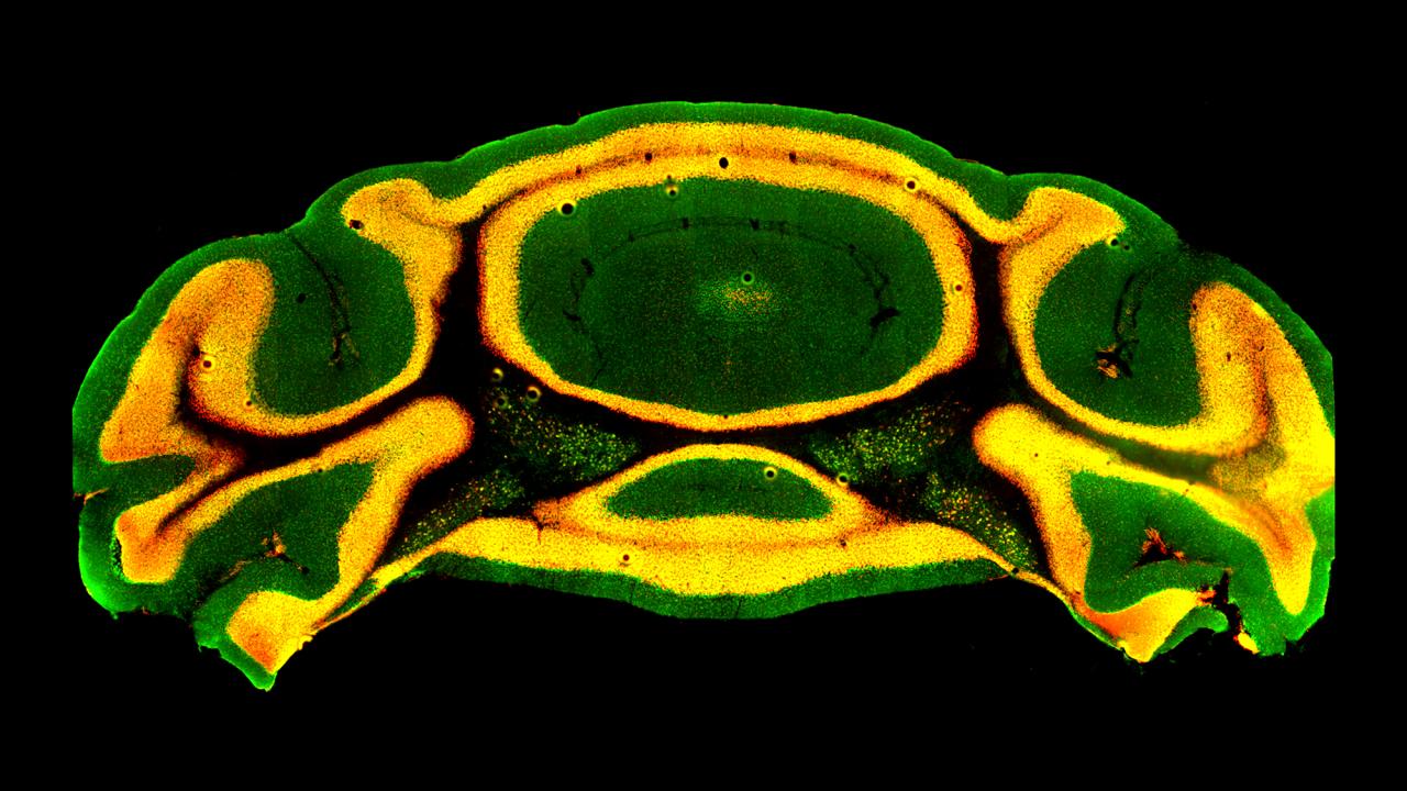 UC Davis researchers are investigating whether a gene called Chd8 mediates the symptoms of autism, in part, by disrupting the function of the cerebellum. Shown here is the cross section of a mouse cerebellum, with orange fluorescence revealing nerve cells that express Chd8. (Se Jung Jung, Fioravante lab / UC Davis)