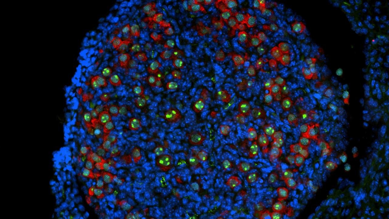Research in the Department of Microbiology and Molecular Genetics suggests that a crucial event happens around the time of birth: the nascent egg cells enter a holding pattern, with their DNA precisely packaged and primed for fertilization later in life. Shown here is ovary tissue from a newborn mouse, with immature egg cells fluorescing green and red. (Yasuhisa Munakata/UC Davis)