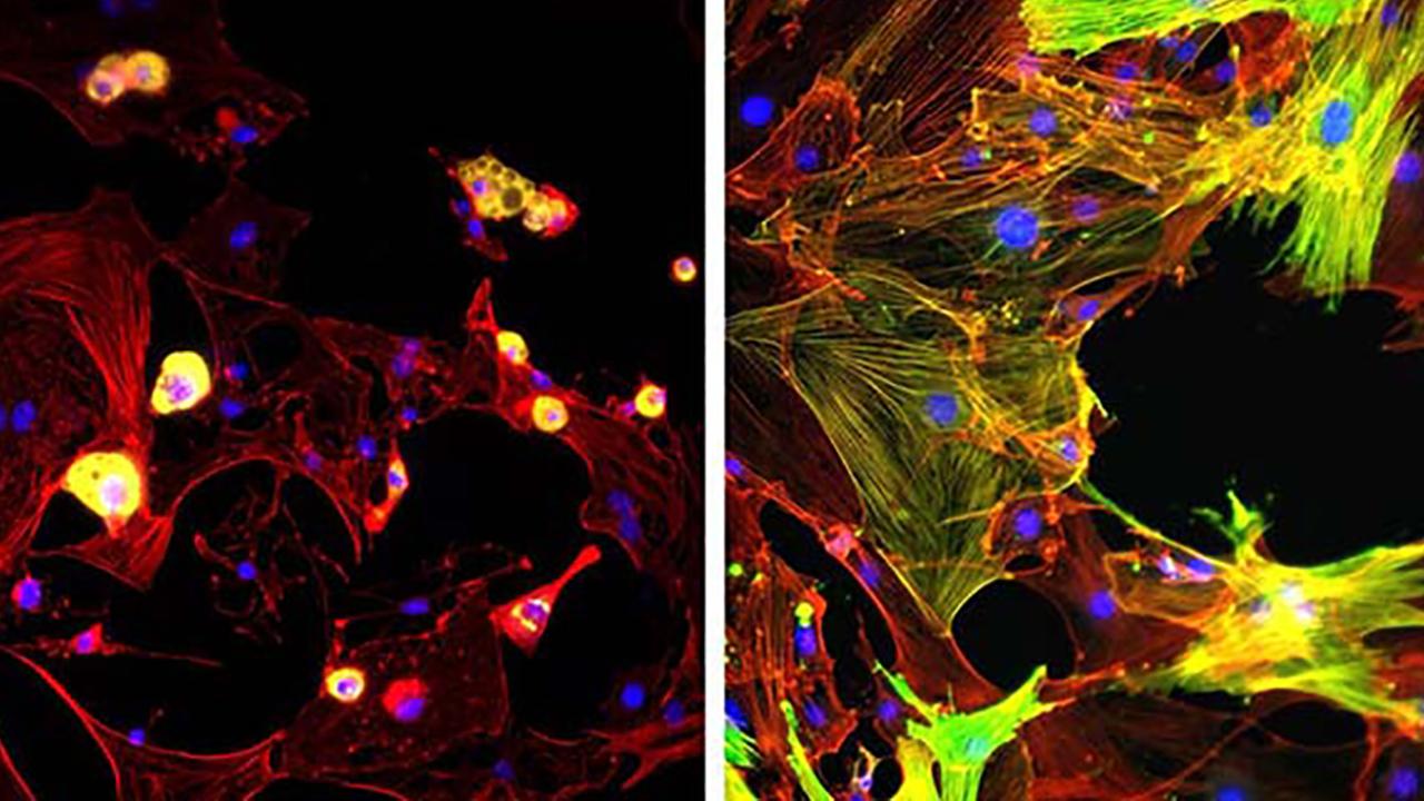 Micro imagery of cells and tissue