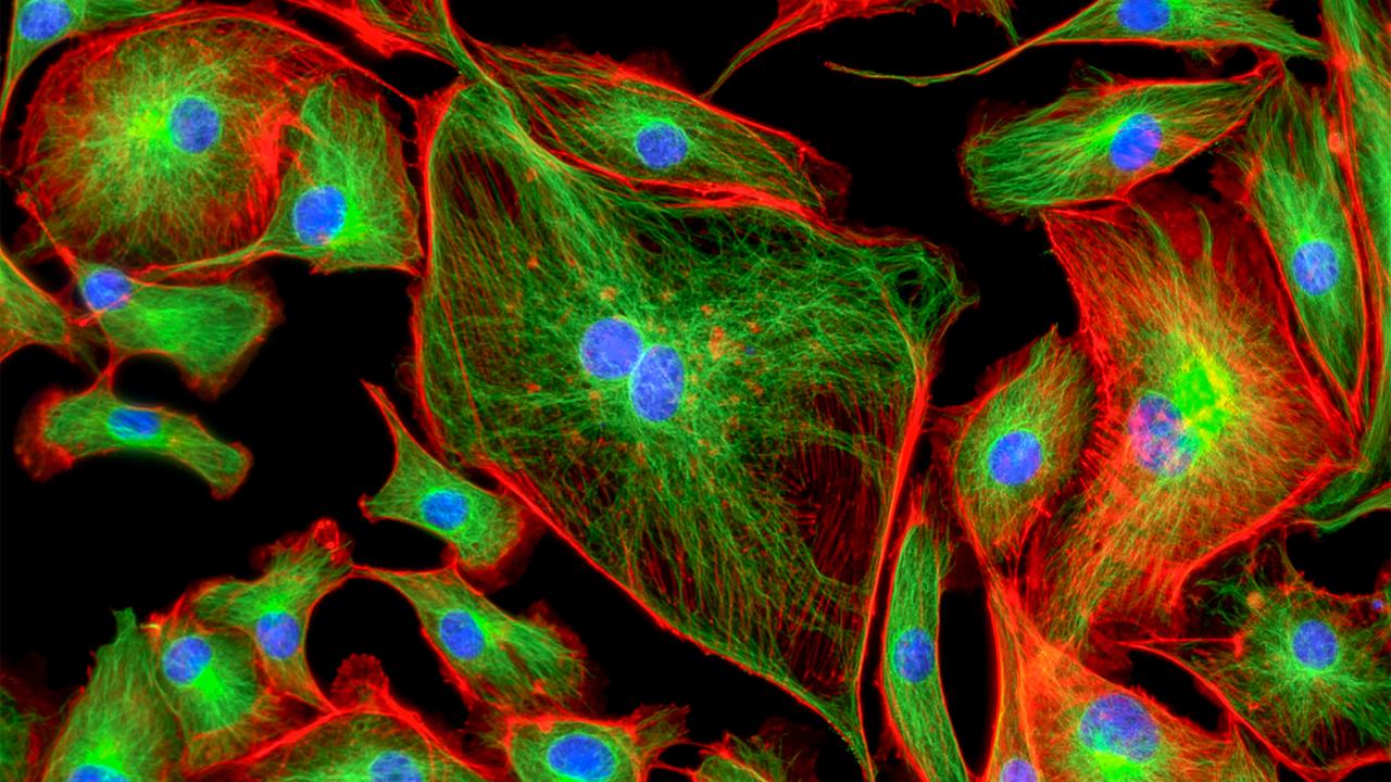 Bovine epithelial cells in red and green