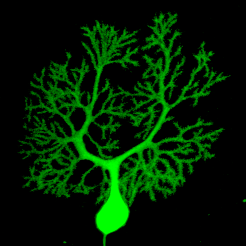 Certain variants of the gene Chd8 may increase the risk of autism, in part, by altering the connections between the cerebellum and other brain structures. Shown here is a single Purkinje cell in the cerebellum, which acts as a gatekeeper for information arriving from other brain areas. (Alexa D'Ambra, Fioravante lab)