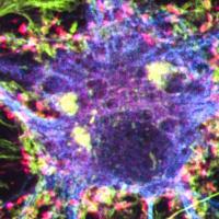 Neural image