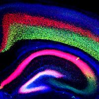Mouse brain scan