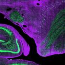 Micrograph of rhesus monkey brain