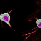 Neurons identified with a new tool from the Kim lab that labels cells undergoing elevated calcium signaling. Green and red show expression of the two halves of the calcium sensor, and magenta shows the expression of the tag that marks activated neurons. (Run Zhang, Kim Lab / UC Davis)