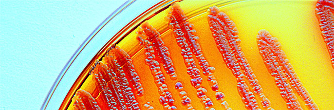Credit: UC Davis AstRoNA Biotechnologies is working to create a hand-held device that can be used to detect a variety of pathogens, including foodborne pathogens like E. coli, pictured here.