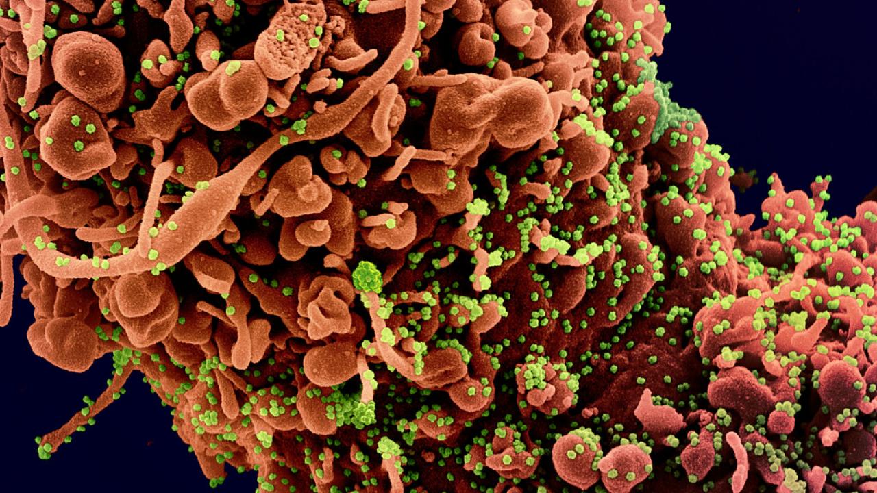 Colorized scanning electron micrograph of a cell showing morphological signs of apoptosis, infected with SARS-COV-2 virus particles (green), isolated from a patient sample. NIAID Coronavirus on cells