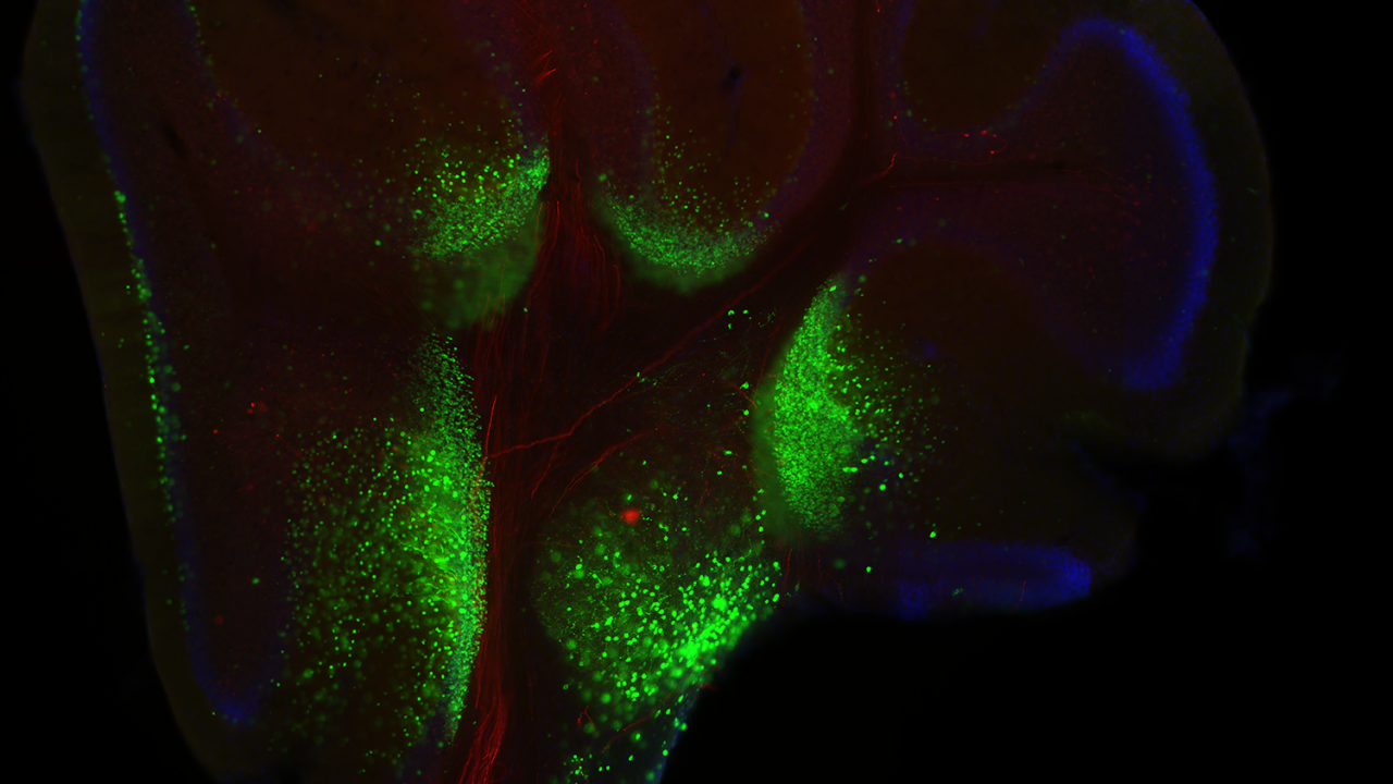 Center for Neuroscience researchers reveal the brain’s mysteries and leverage these discoveries to promote health, advance treatments and cures for neurological and psychiatric disorders, and stimulate next generation transformative technologies to improve lives. This image of a cerebellum comes from Assistant Professor Diasynou Fioravante's lab. Cerebellum