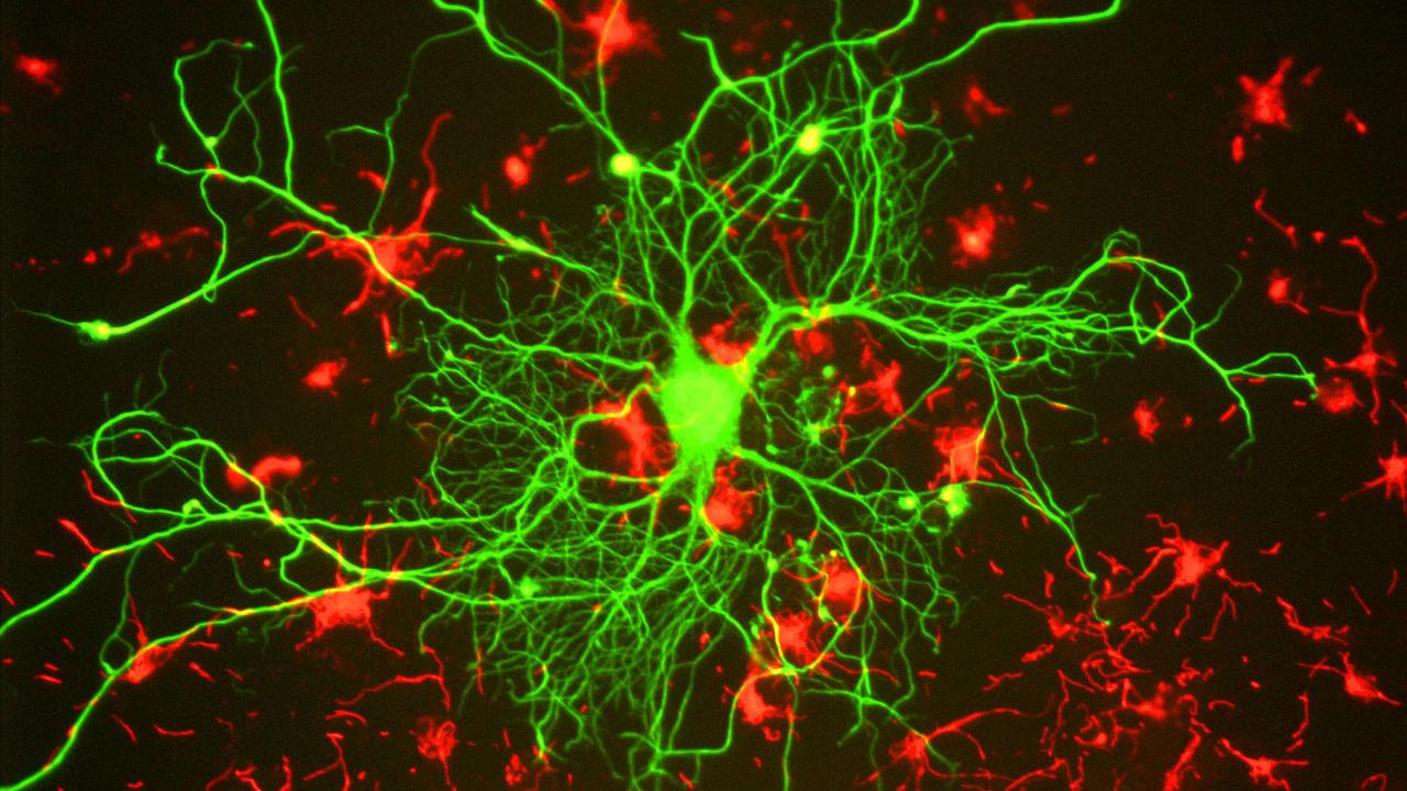 Researchers hope to gain a better visual perspective of the molecular mechanisms of the brain's continual rearrangement of neuronal connections, known collectively as brain plasticity. Gerry Shaw Researchers hope to gain a better visual perspective of the molecular mechanisms of the brain's continual rearrangement of neuronal connections, known collectively as brain plasticity. Gerry Shaw