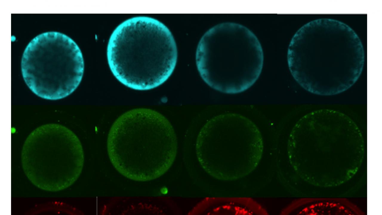 Each column represents an oocyte stained with markers of metabolism, such as anti-oxidants (blue), stress/reactive oxygen species (green) and active mitochondria (red, the cell’s “power station”). CNBP Oocyte cells
