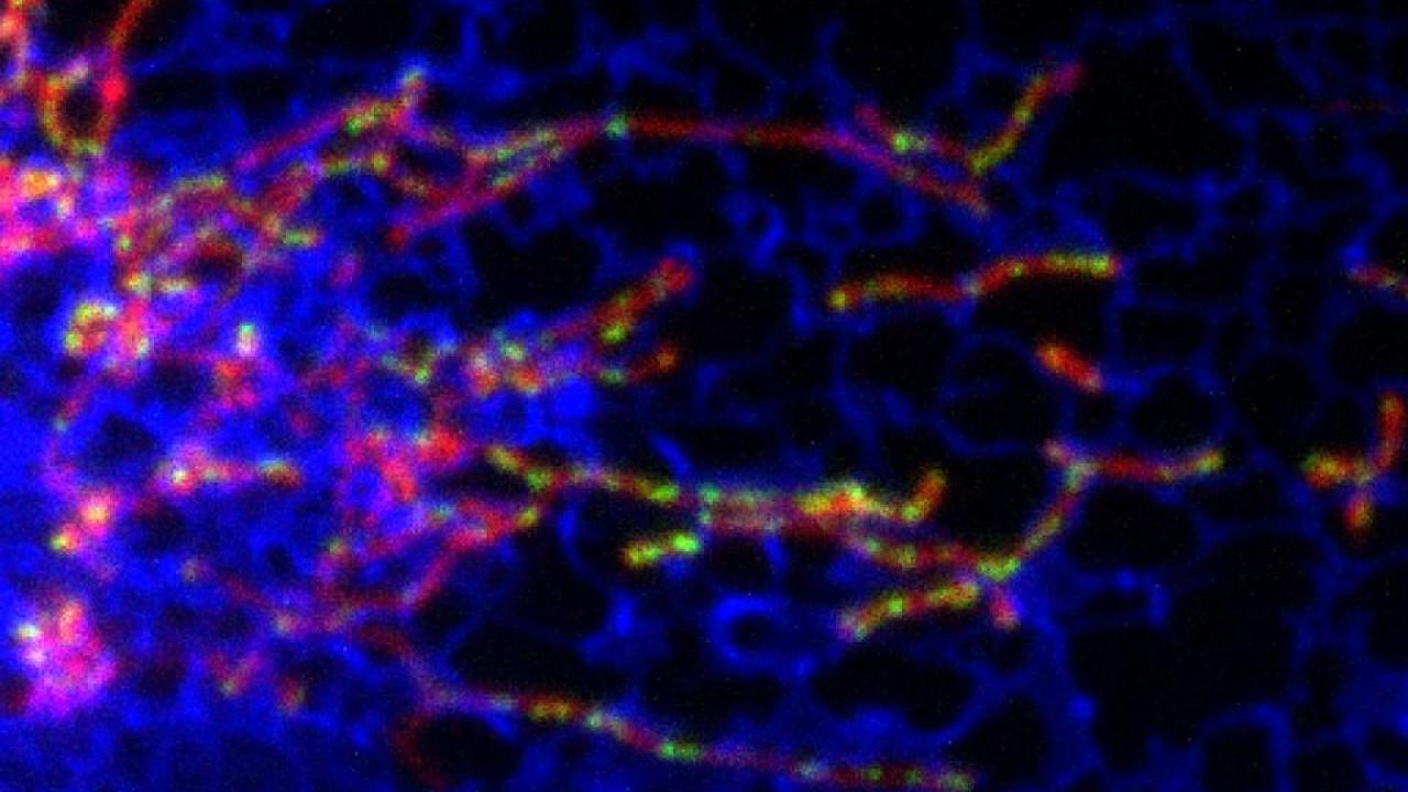 Mitochondria play a vital role in cell health and disease and have their own DNA. New UC Davis research shows that mitochondrial DNA (green spots) is found at points where mitochondria (blue) are in contact with a network of tubes called the endoplasmic reticulum (red). This explains how division and separation of mitochondria is controlled. Credit: Samantha Lewis Aging, neurodegenerative disorders and metabolic disease are all linked to mitochondria, structures within our cells that generate chemical energy and maintain their own DNA. In a fundamental discovery with far-reaching implications, scientists at the University of California, Davis, now show how cells control DNA synthesis in mitochondria and couple it to mitochondrial division.