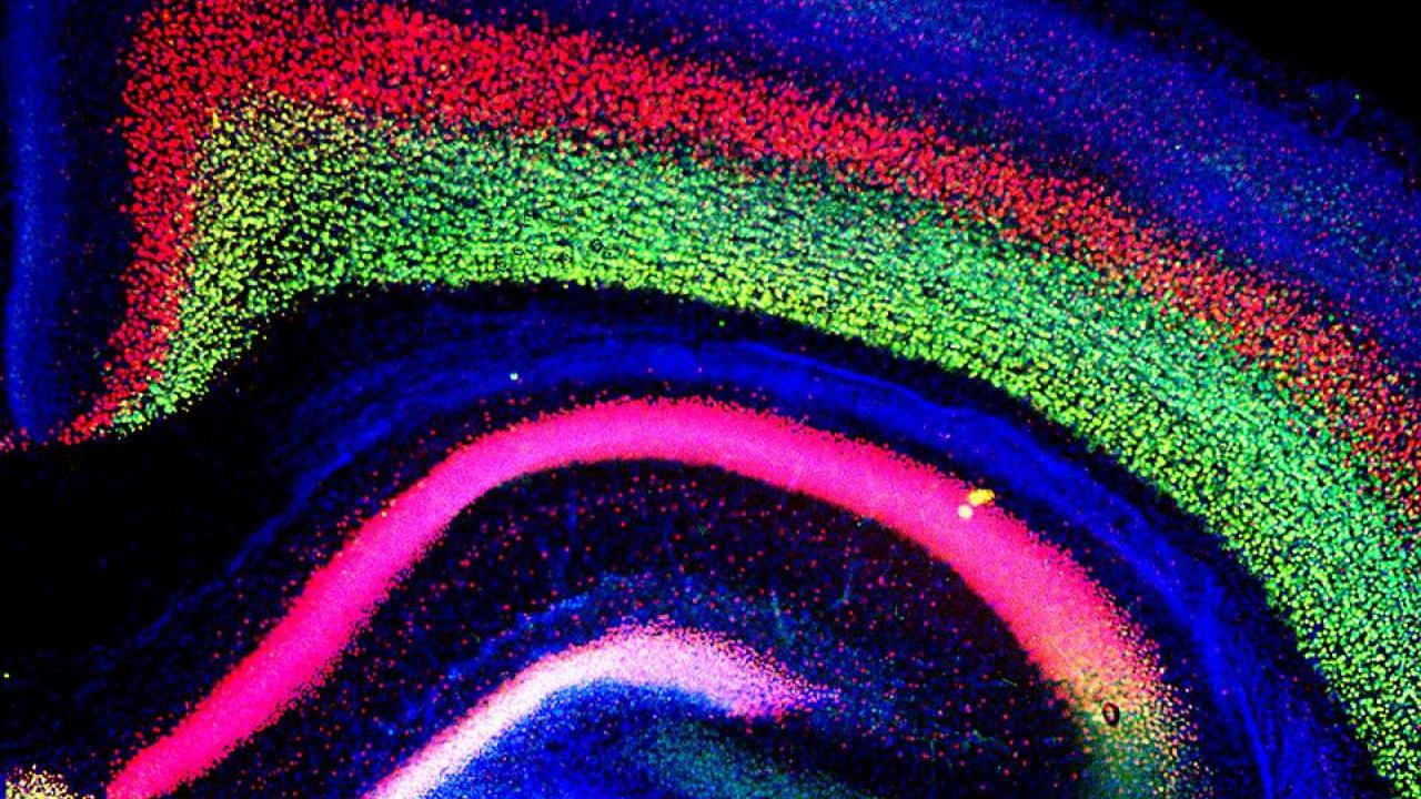 In this mouse cortex, a mutation in the CHD8 gene caused increased brain size, or megalencephaly, a condition also present in people with autism spectrum disorder. The colored sections correspond to different layers of the developing cortex. Alex Nord/UC Davis In this mouse cortex, a mutation in the CHD8 gene caused increased brain size, or megalencephaly, a condition also present in people with autism spectrum disorder. The colored sections correspond to different layers of the developing cortex. Alex Nord/UC Davis