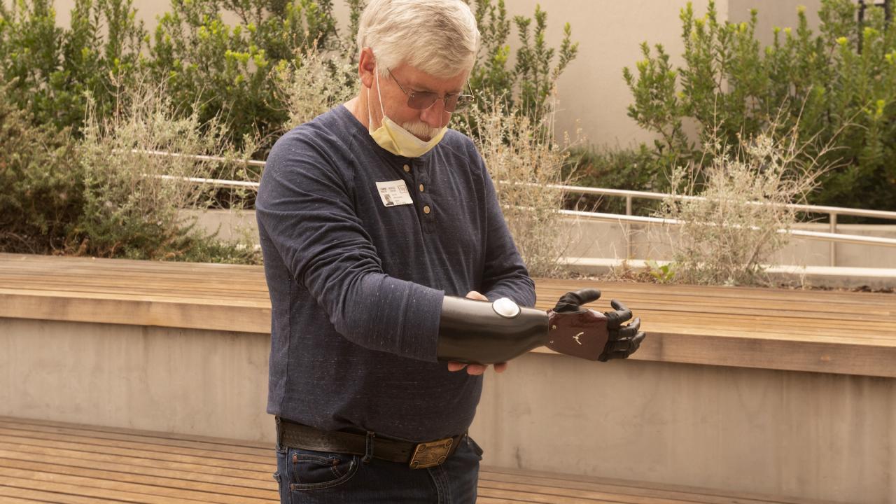 Man standing outside with a prosthetic arm