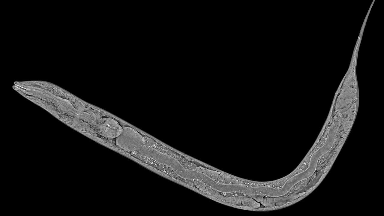 Grayscale microscopic nematode (roundworm) curved on black background