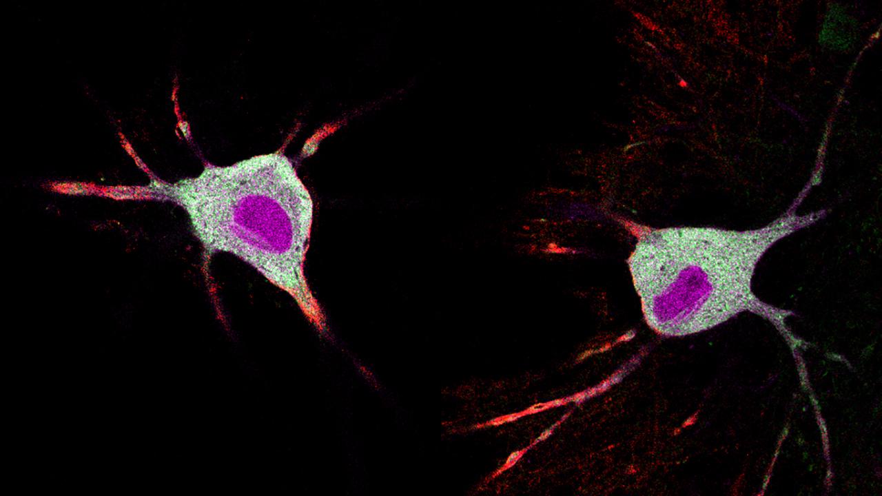 Neurons identified with a new tool from the Kim lab that labels cells undergoing elevated calcium signaling. Green and red show expression of the two halves of the calcium sensor, and magenta shows the expression of the tag that marks activated neurons. (Run Zhang, Kim Lab / UC Davis)