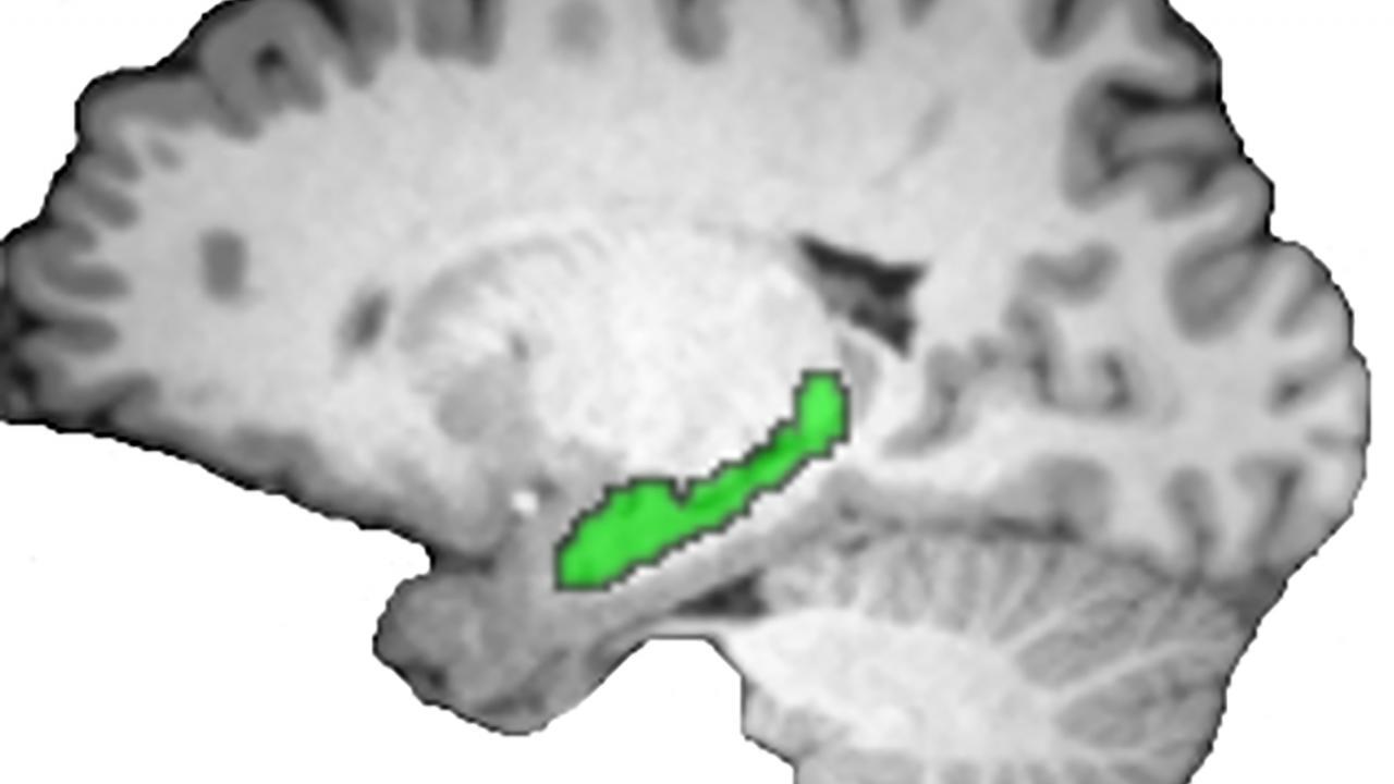 Brain scan depicting hippocampus