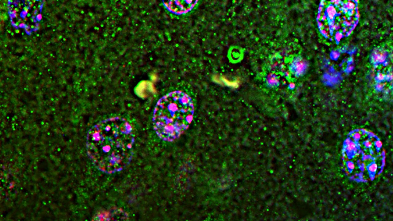 Micrograph of green and purple dots
