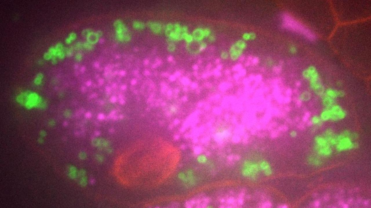 A fluorescence microscopy image showing a cell with bright magenta regions highlighting internal structures, and scattered green fluorescence representing other cellular components. A red circular structure is also visible within the cell.