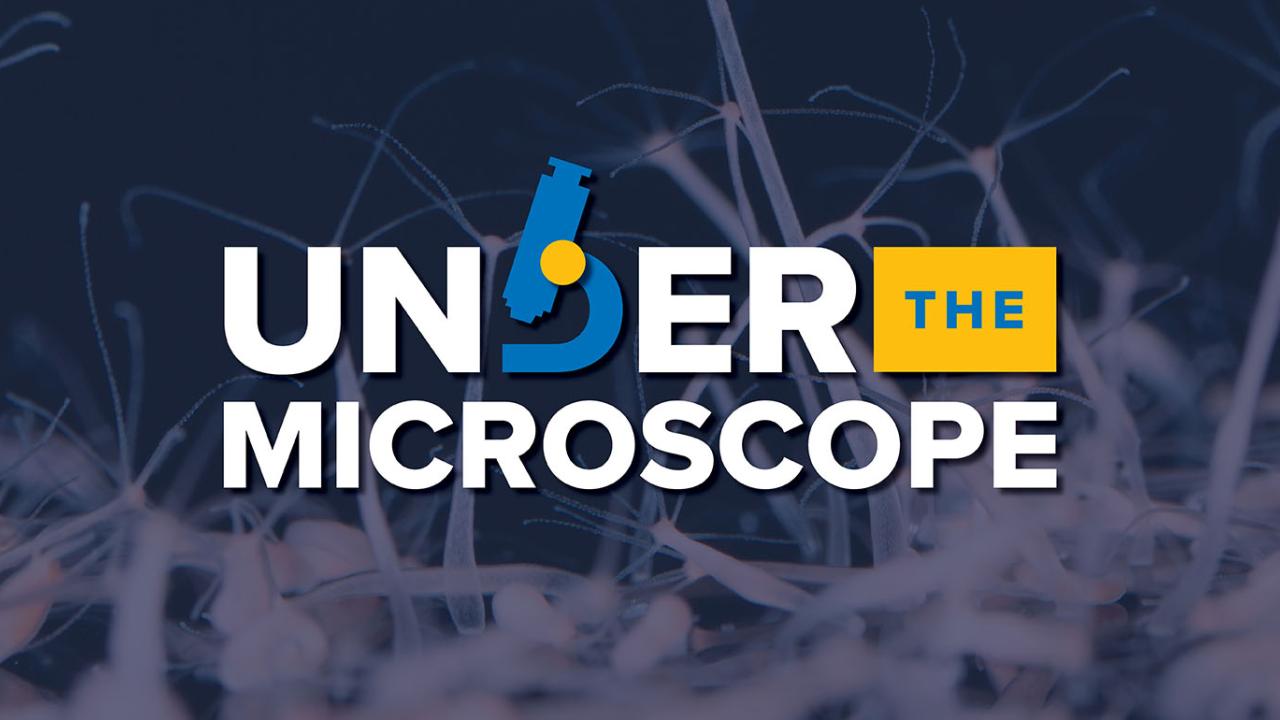 Banner image featuring the words 'Under the Microscope' in bold white text, with a microscope icon replacing the letter 'D' and a yellow box highlighting the word 'THE'; background shows magnified biological structures resembling hydra or similar microscopic organisms.