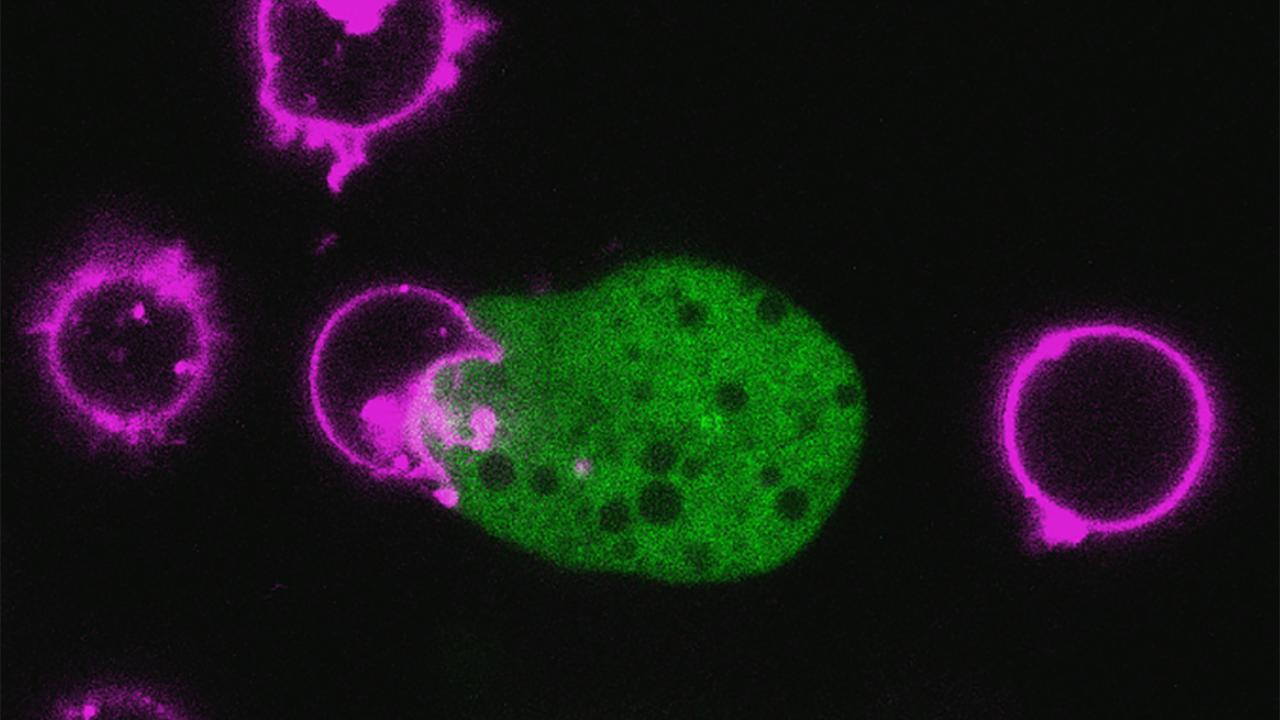 Fluorescent microscopy image showing a green-colored Entamoeba histolytica parasite in contact with several magenta-colored circular human T-cells, illustrating the parasite’s attack on immune cells.