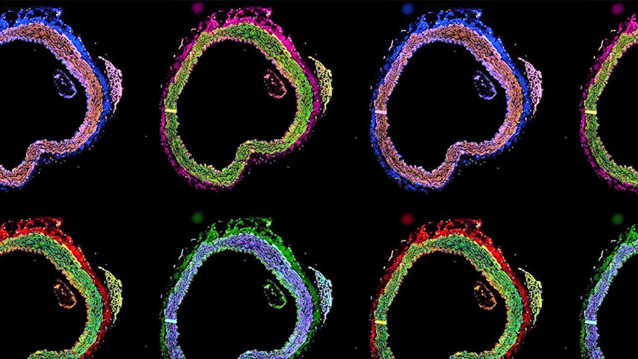 A grid of eight fluorescent images showing cross-sections of an aorta. Each section is highlighted with vibrant colors, including blue, green, red, and pink, representing different molecular or cellular markers. The sections are arranged in two rows, each with four columns, against a black background.
