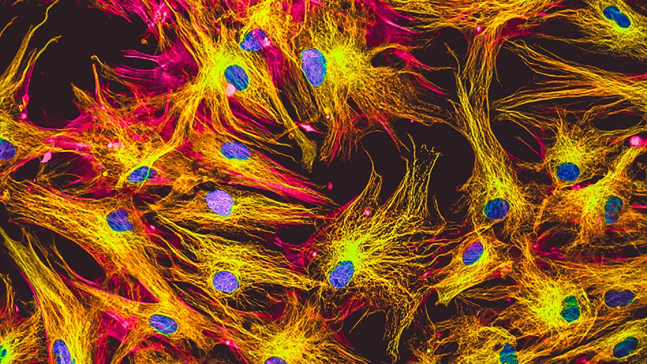 In festive holiday colors, human skin cells in culture. Nuclei are in blue, actin filaments are in pink, tubulin was labeled with green.