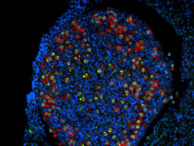 A fluorescence microscopy image of an ovary section, with blue-stained nuclei, red proteins, and green molecular markers, highlighting cellular organization and function.