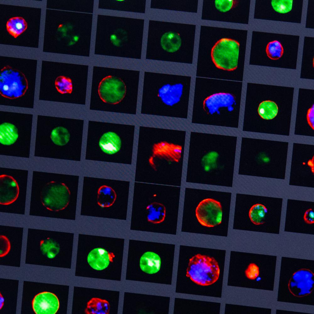 Colorful fluorescent images of cells display structural differences under a microscope, illustrating advanced cellular research.