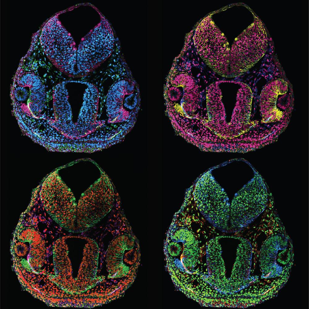 Four multicolored fluorescent images of a cross-sectioned zebrafish head show cellular structures in high detail.