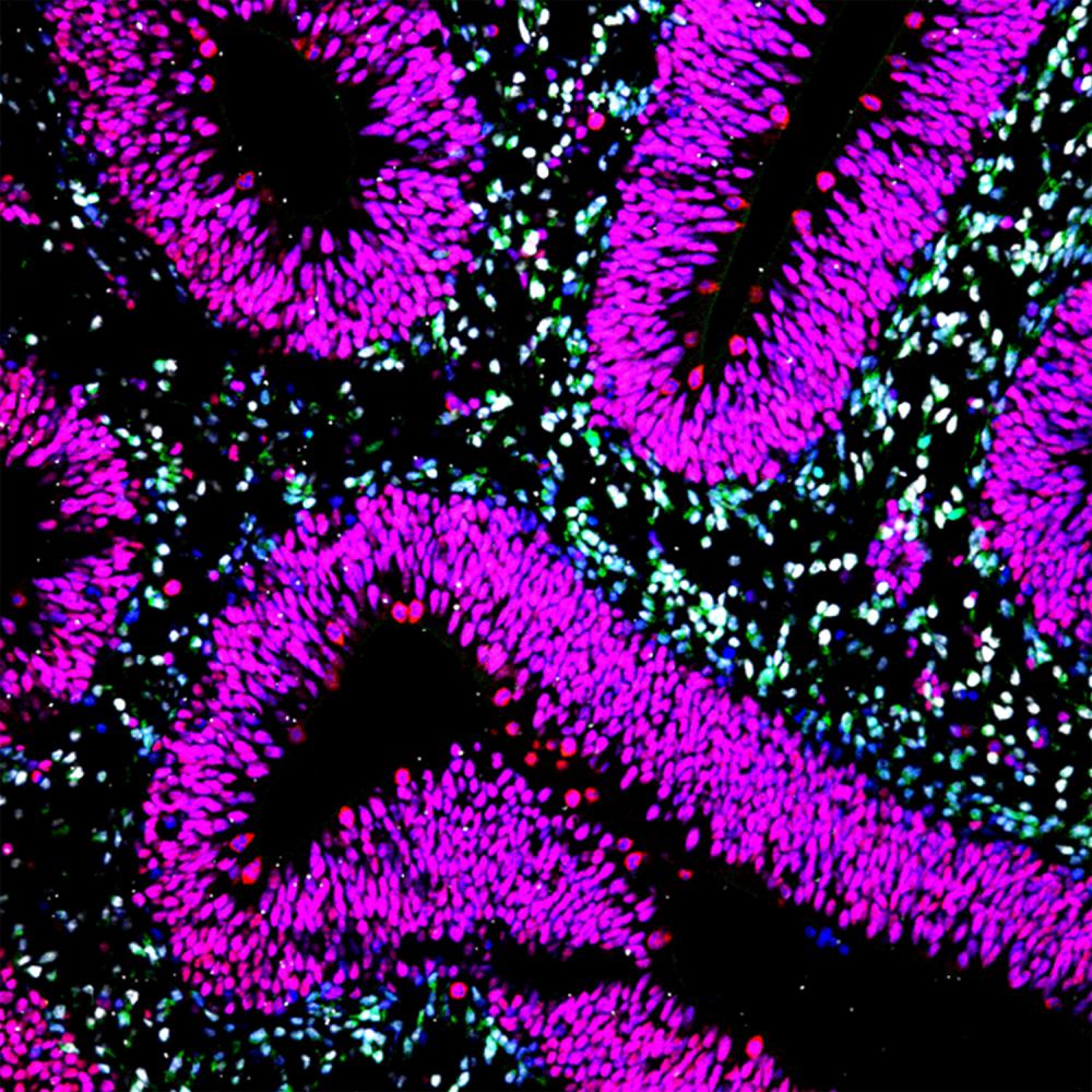 Fluorescent microscopy image showing layered cell structures in bright magenta, cyan, and blue hues in a curved tissue section.