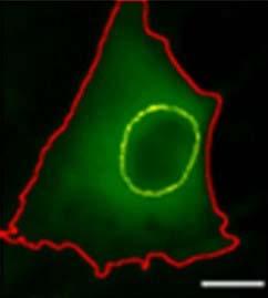 Red and green micrograph