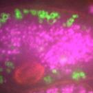 A fluorescence microscopy image showing a cell with bright magenta regions highlighting internal structures, and scattered green fluorescence representing other cellular components. A red circular structure is also visible within the cell.