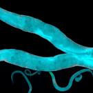 A fluorescent microscopy image of two glowing turquoise nematodes against a black background, with red-highlighted structures scattered throughout their bodies.